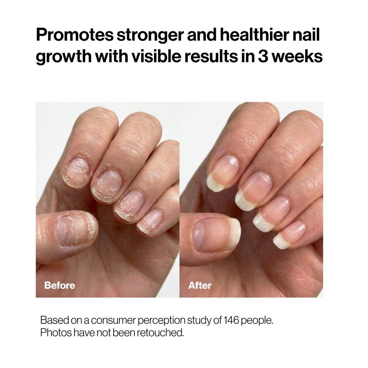 Nourishing Nail Pen